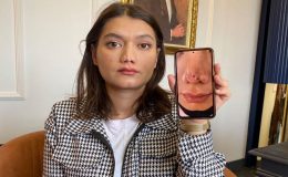 Burun Estetiği Yaptırdı, Hayatı Karardı